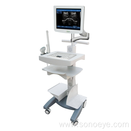 Trolley type ultrasound machine for clinic